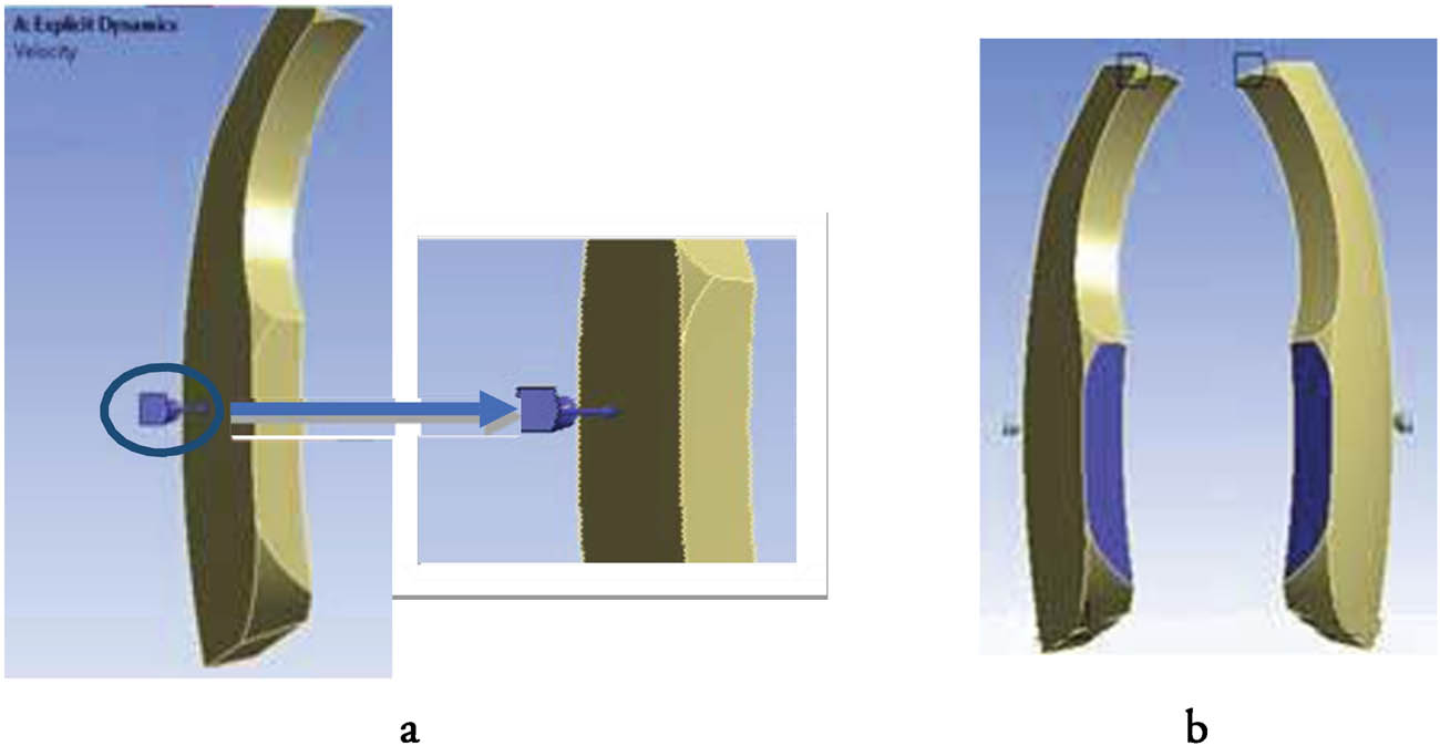Figure 27 
                  Design of the bulletproof vest: (a) provision of the burden of a speeding bullet 426 m/s and (b) fixed support [161].
               