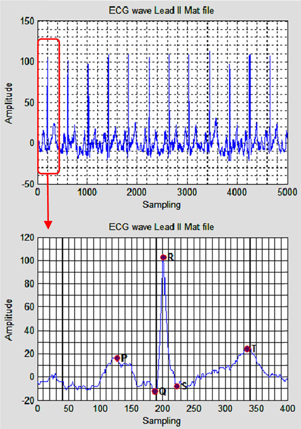 Design of a web laboratory interface for ECG signal analysis using ...
