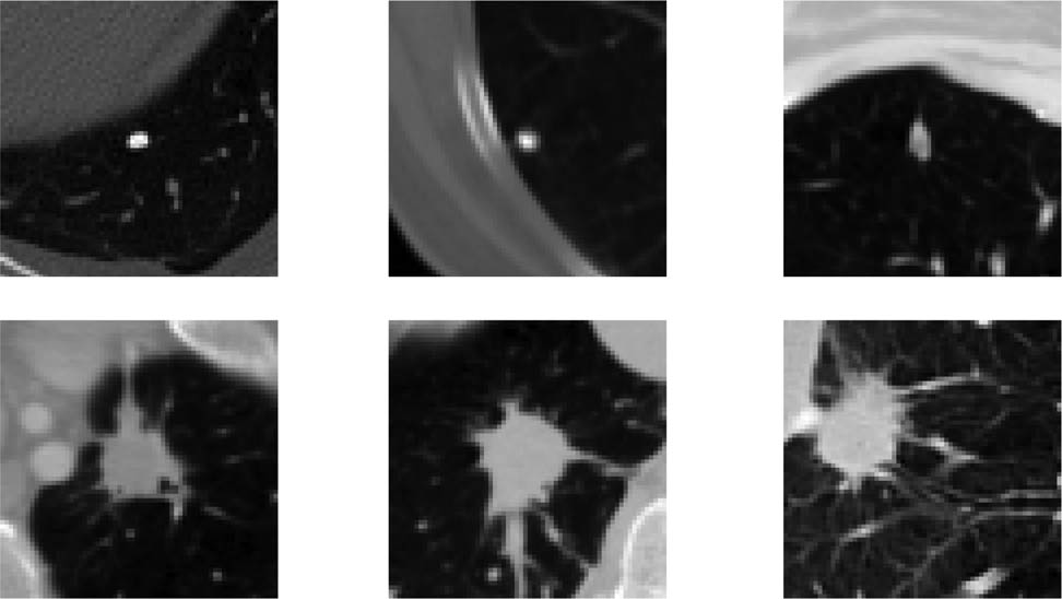 Figure 1
The samples of different pulmonary nodules.