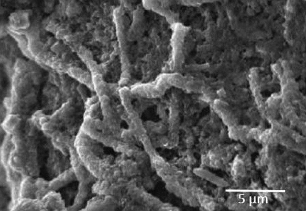 Figure 2: 
					SEM micrograph of A. israelii biofilm on the copper surface.
				