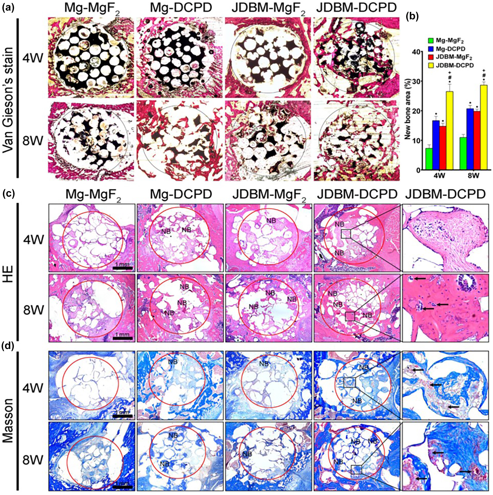 Figure 20: 
						Comparison of bone regeneration, growth and integration in different scaffold-coating cases.
						(a) Van Gieson staining of undecalcified sections (red portion – bone tissue, black portion – residual scaffold material), (b) quantitative analysis of newly formed bone, (c) HE staining (black arrow – vascular formation), (d) Masson staining (black arrow – osteoid) showing newly mineralized bone tissue (NB). (*, # and + represent P < 0.05 or statically significant when compared with Mg-MgF2, Mg-DCPD and JDBM-MgF2, respectively). Reprinted from (Wang et al. 2020) with permission from Elsevier.
					
