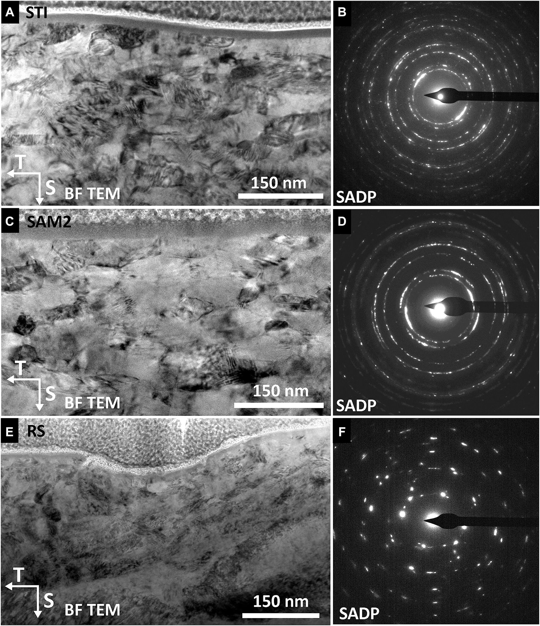 Figure 5:
BF TEM image of the UFGL associated with the machined surface on the T-S plane of Alloy 182 and SADP acquired within the UFGL for (A, B) STI, (C), (D) SAM2 and (E), (F) RS surfaces; a continuous darkly-imaging contaminant layer (∼15–20 nm in thickness) is observed in (A) and (C).