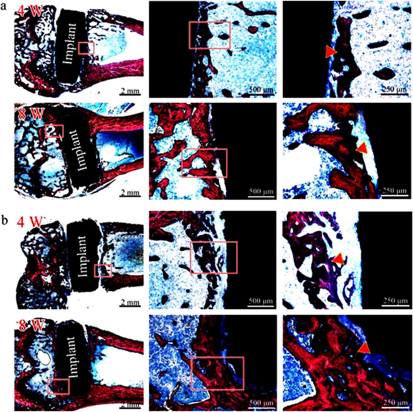 Figure 11: 
Histological staining (Van Gieson) of hard tissue sections at weeks 4 and 8 for (a) pure Zn and (b) Zn–5HAP composite. Red rectangles: magnified bone-implant interface, red triangle: newly formed bone. Reprinted from Yang et al. (2018) with permission from Elsevier.
