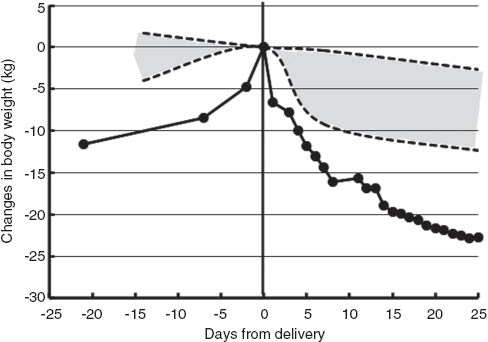 Figure 1 
					Perinatal changes in body weight in this patient with peripartum cardiomyopathy.
					The shaded area indicates the range of the 2.5th–97.5th percentile value obtained from 272 control women with neither hypertension nor pregnancy-induced antithrombin deficiency [10].
				