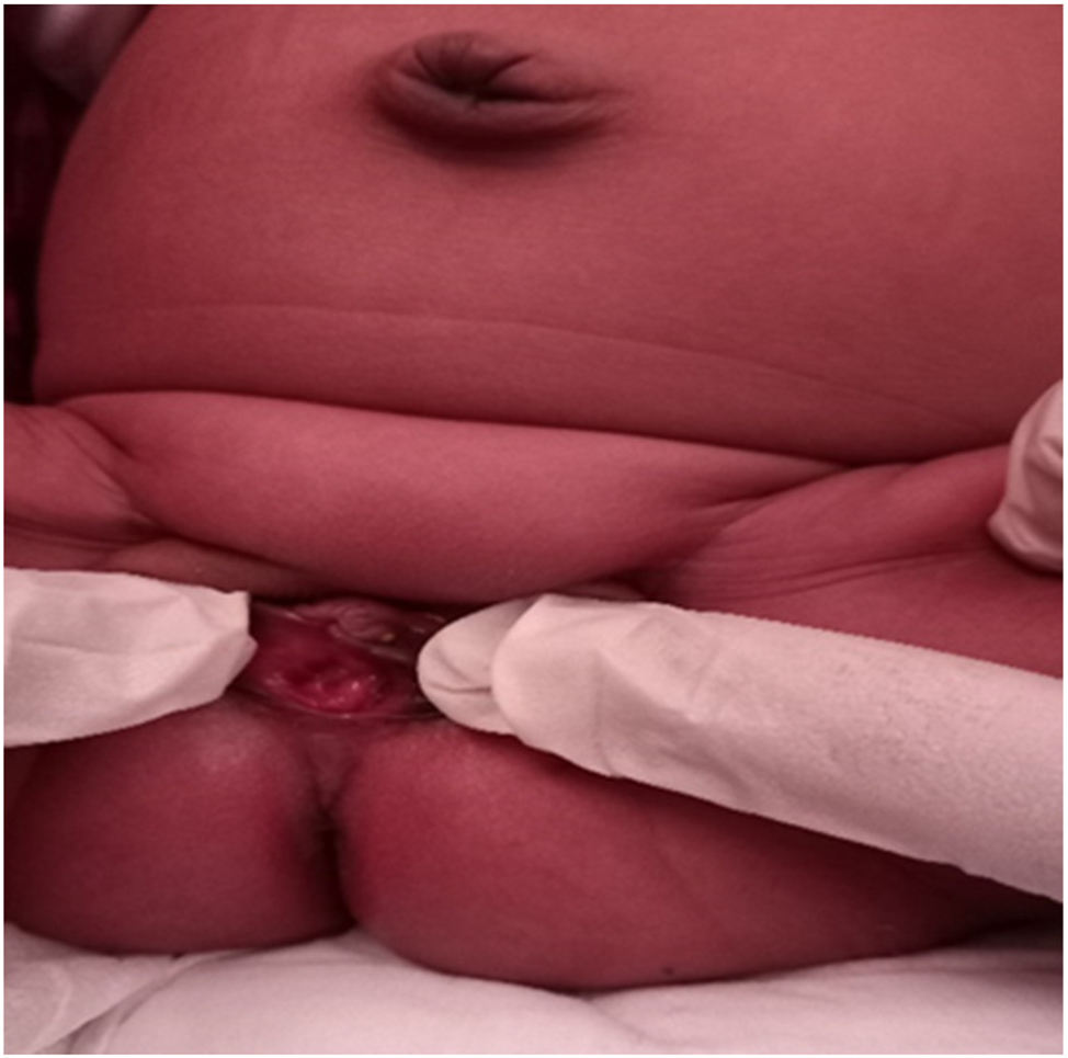 hymen child 