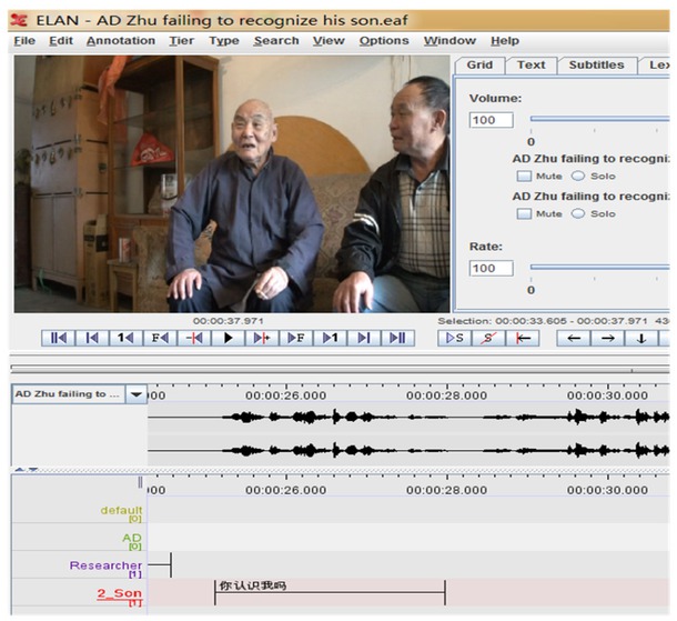 Figure 7 
					Visual agnosia of an Alzheimer’s disease patient
				