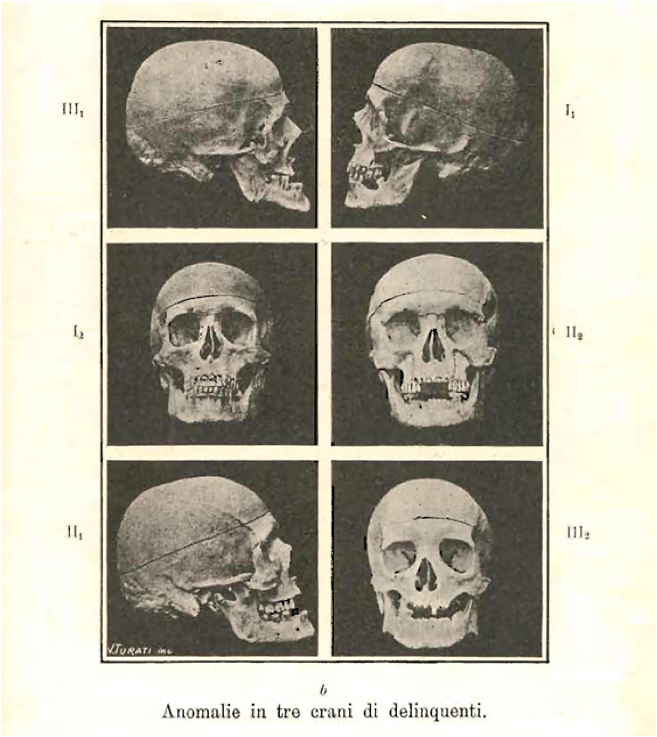Figure 3: 
Example of cranial abnormalities of delinquents in Lombroso’s Atlas (Lombroso 1897: 4, Table XXVII, detail, image in the public domain).
