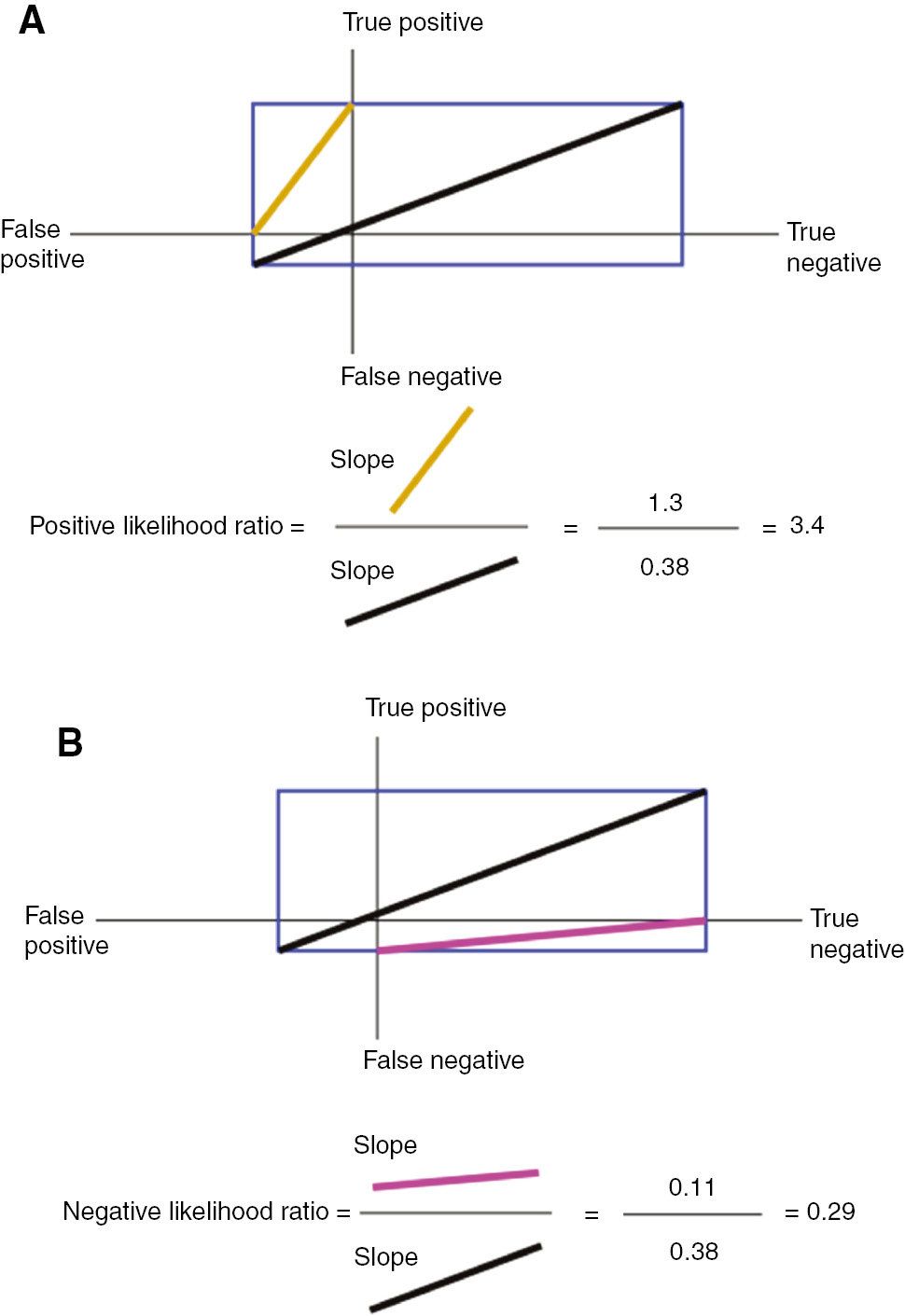 Figure 7: (A) The positive likelihood ratio is the ratio of two odds, that is, the odds in favor of having the disorder once a positive test result is known (slope of brown), divided by the odds in favor of having the disorder before the test was performed (slope of black). Conventionally, a value of 10 or greater is considered “good”. (B) The negative likelihood ratio is the ratio of two odds, that is, the odds in favor of having the disorder once a negative test result is known (slope of purple), divided by the odds in favor of having the disorder before the test was performed (slope of black). Conventionally, a value of 0.1 or less is considered “good”.