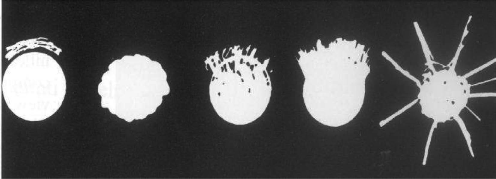 Figure 9: Examples of tumor mass margins which represent the spectrum of cancer malignancy.Further examples will show that these features of malignancy acquire their meaning from the causal grasping of the situation, not the other way around.