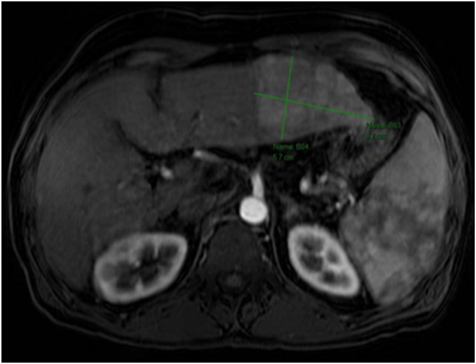 Teaser image from the article