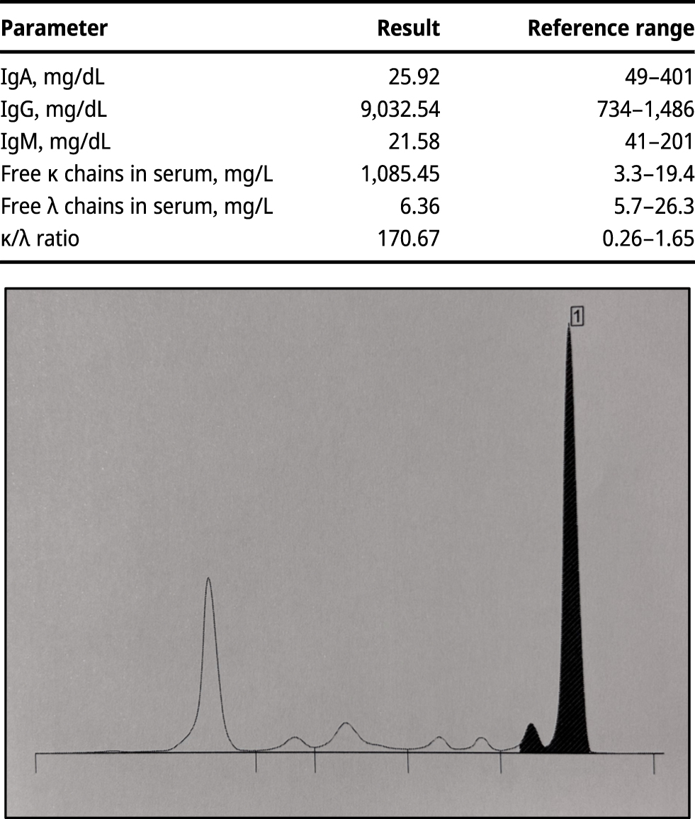 Teaser image from the article