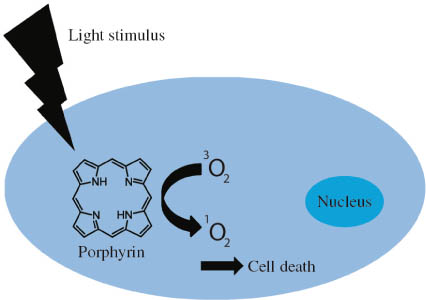 Figure 3 Light activation of a photosensitizer leads to the formation of highly reactive singlet oxygen for selective cell killing.