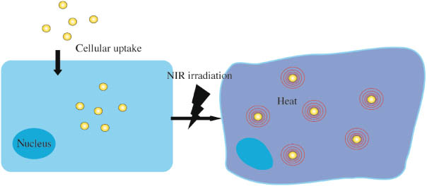 Figure 5 Photothermal therapy is based on intracellular uptake of gold nanoparticles, which after irradiation with near-infrared light convert absorbed light into thermal energy for specific destruction of cancer cells.