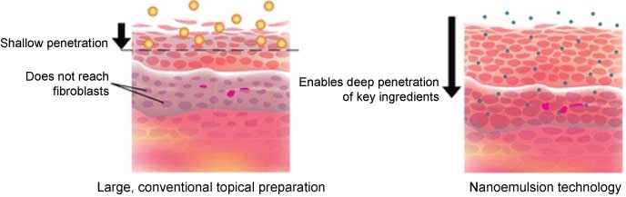 Figure 6 Comparison of nanoemulsion with the conventional transdermal formulations in case of crossing skin barrier.