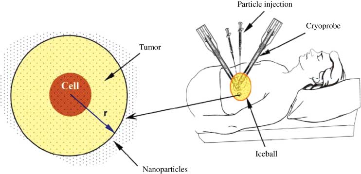 Figure 3 Schematic illustration of computational domain loaded with nanoparticles during cryosurgery (not to scale) (133).