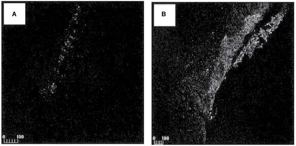 Figure 2 Confocal laser scanning microscopy images of colon cross sections from the healthy control group after administration of 100-nm particles (A) and the colitis group after administration of 100-nm particles (B). Scale bars represent 100 μm, with kind permission from Springer Science+Business Media: (95) Lamprecht et al. Size dependent bioadhesion of Micro-and Nanoparticulate carrier to the inflamed colonic mucosa. Pharm Res 2001;18:788–93.