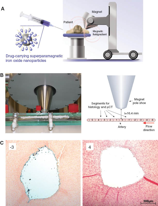 Figure 1 Magnetic drug targeting.(A) Principle of the MDT method; (B) Superparamagnetic iron oxide nanoparticle accumulation in a bovine artery using magnetic field: Photo shows the ex vivo bovine artery model (left panel), experimental setup is schematically presented in the right panel; (C) Histochemical analysis of iron accumulation (Prussian blue staining) in the aortic segments relative to the magnet positioning (68).
