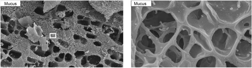 Figure 4 Representative cryo-SEM images of pulmonary mucus.The cryo-SEM images of mucus show the strongly heterogeneous nature of mucus polymer mesh (left image). Large as well as very small pores can be observed (left image). Furthermore, the enlarged view of the mucus (right image, representing the area on the left image indicated by a square) shows a thick wall of the polymer scaffold (Scale bar: left 10 μm; right 500 nm.). From reference (79), reprinted with permission from PNAS.