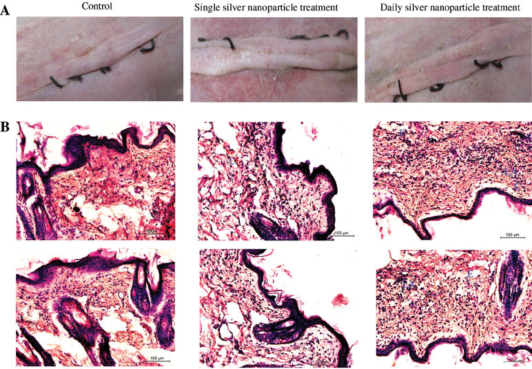 Figure 10 Gross evaluation of the operative site on day 14 showed completely healed wound in all treatment groups, there was no sign of local edema or erythema in any treatment group (A). The section of the skin from both single and daily silver nanoparticles treated animals showed sub epidermal edema with focal areas of lymphocytic aggregation and few congested blood vessels. Whereas skin sections from control animals showed normal architecture (B). Magnification: x200.
