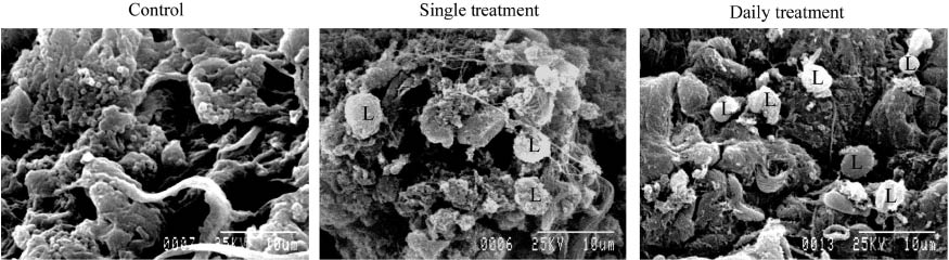 Figure 11 Scanning electron microscopy showed increased infiltration of leukocytes (L) in both single and daily silver nanoparticles treated animals.