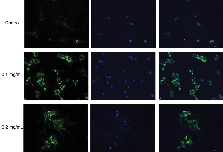 Figure 2 Silver nanoparticles induce expression of collagen-I in skin fibroblasts.Immunocytochemistry shows increased expression of collagen-I from cultured fibroblast cells treated with different doses of silver nanoparticles (column 1), DAPI stained (column 2) and merged images (column 3).