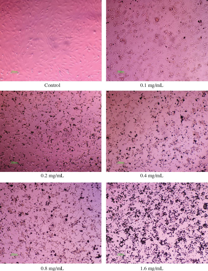 Figure 3 Silver nanoparticles reduce the survival of skin fibroblasts. Images of skin fibroblast cells treated with incremental doses of silver nanoparticles show decrease in number of cells.