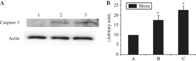 Figure 5 Silver nanoparticles induce caspase 3 in skin fibroblasts. A. Western blot analysis shows increased expression of caspase 3 in silver nanoparticle treated fibroblasts compared to normal cells, Lane1: Normal cells, Lane 2: Cells treated with 0.2 mg/mL silver nanoparticles, Lane 3: Cells treated with 0.4 mg/mL silver nanoparticles. B. Bar diagram showing mean ± sd values.