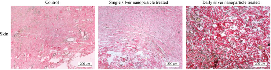 Figure 8 Daily treatment of silver nanoparticles increased collagen deposition on the operation site. Sirius red staining showed increased collagen staining of skin sections from daily silver nanoparticles treated animals compared to single treated and control animals. Magnification: x100.