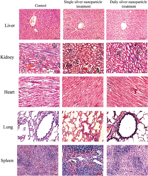 Figure 9 Silver nanoparticles did not change the histology of vital organs. Histopathology of liver, kidney, heart, lung, spleen from silver nanoparticle treated animals did not show any change from the normal architecture. Magnification: x200.