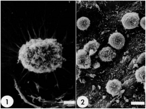 Figure 1: Porcine Pulmonary Intravascular Macrophages (PIM cells).1) PIMs reaching out with pseudopods attached to the surface of plastic coverslip after 1 h incubation (sizebar 2 μm); 2) PIMs showing rounded shape, ruffled membrane. Picture taken after 8 h incubation on the pulmonary artery endothelium ex vivo, sizebar 5 μm. Modified from Ref. (21) with permission.