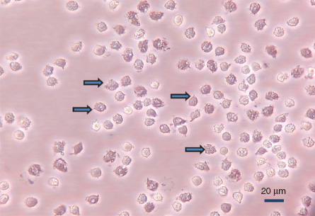 Figure 3: Porcine PIM cells adhered to plastic surface.The dens, larger cells (marked by arrows) show ruffled membrane structures and multiple vacuoles. Cells were washed out from the capillaries by collagenase and let to adhere to gelatin surface for 30 min at 37°C, essentially as described in Ref. (21). Magnification: 40×, unpublished data.