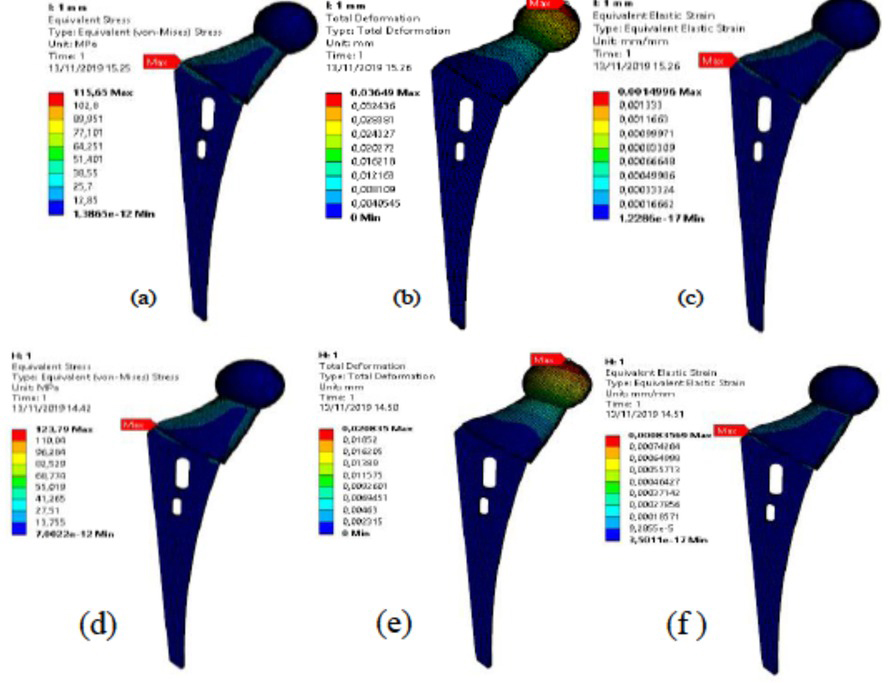 Figure 10 For element size 1 mm on Ti-6Al-4V (a) Stress (von misses), (b) deformation, (c) strain (von misses) and on SS 316 L 4V (d) Stress (von misses), (e) deformation, (f) strain (von misses)