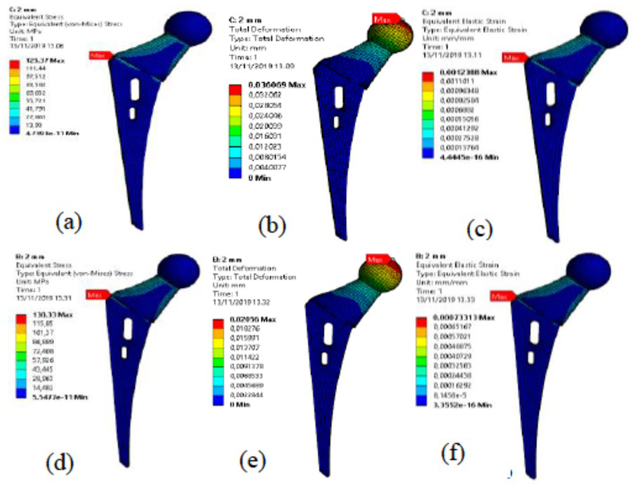Figure 11 For element size 2 mm on Ti-6Al-4V (a) Stress (von misses), (b) deformation, (c) strain (von misses) and on SS 316 L 4V (d) Stress (von misses), (e) deformation, (f) strain (von misses)