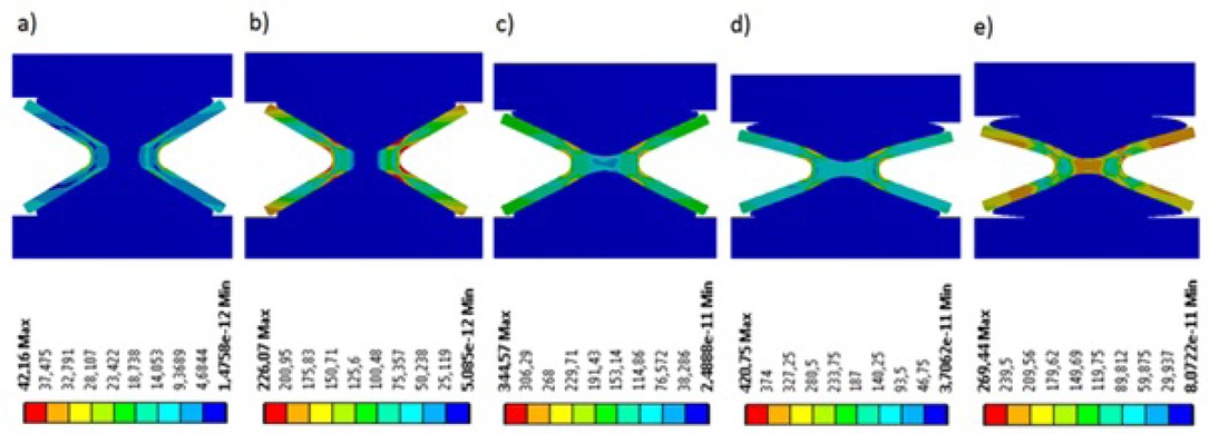 Figure 8 Equivalent stress distribution in MPa of gasket model No. 180: a) compression 0.3 mm, b) compression 0.5 mm, c) compression 1.5 mm, d) compression 3 mm, e) decompression 1.5 mm