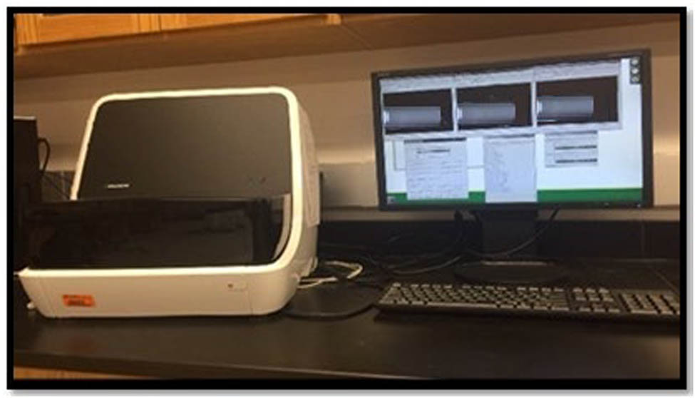 Figure 4 
               Laser Straumann scanning model.
            