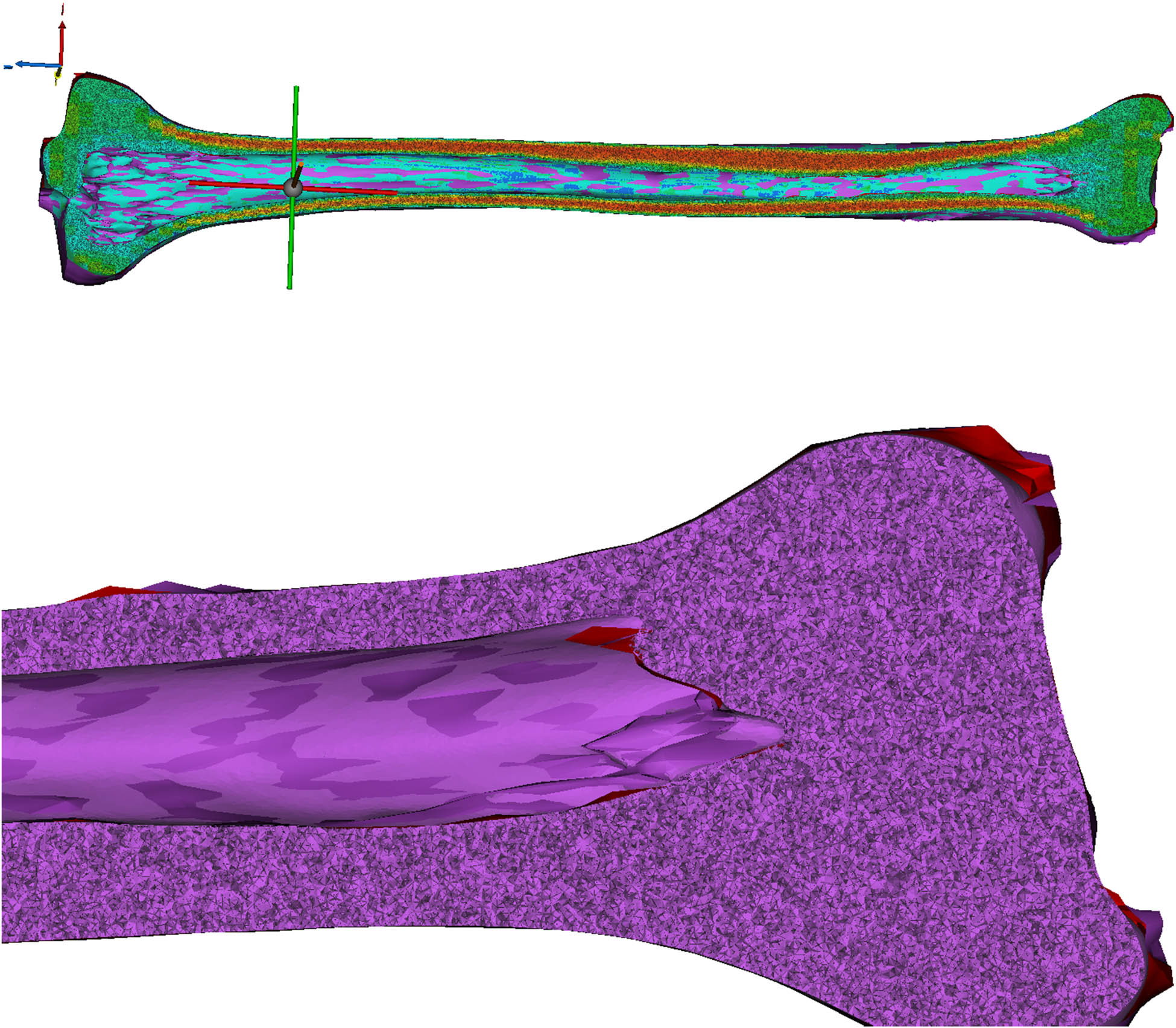 Figure 3 
               Incorporating material attributes based on tibia bone densities and MRI is essential for achieving an identical density to that of genuine tibia bone layers.
            