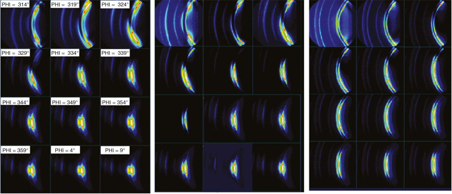 Figure 8: Two-dimensional X-ray spectra on pristine HDPE, subjected to mechanical stress at 500% strain and different temperatures. Left: room temperature. Middle: sample measures at 77°C. Right. Sample measured at 122°C.
