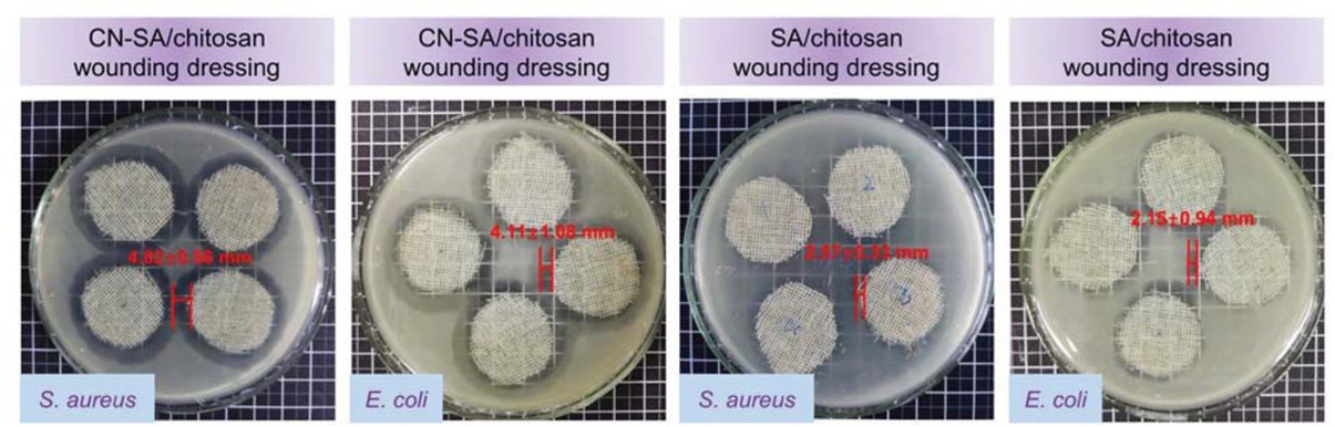 Figure 5 Wound dressing antibacterial properties.