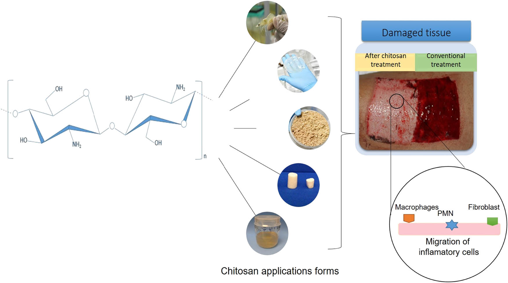 Figure 2 
                  Graphic representation of the application of chitosan in wound healing.