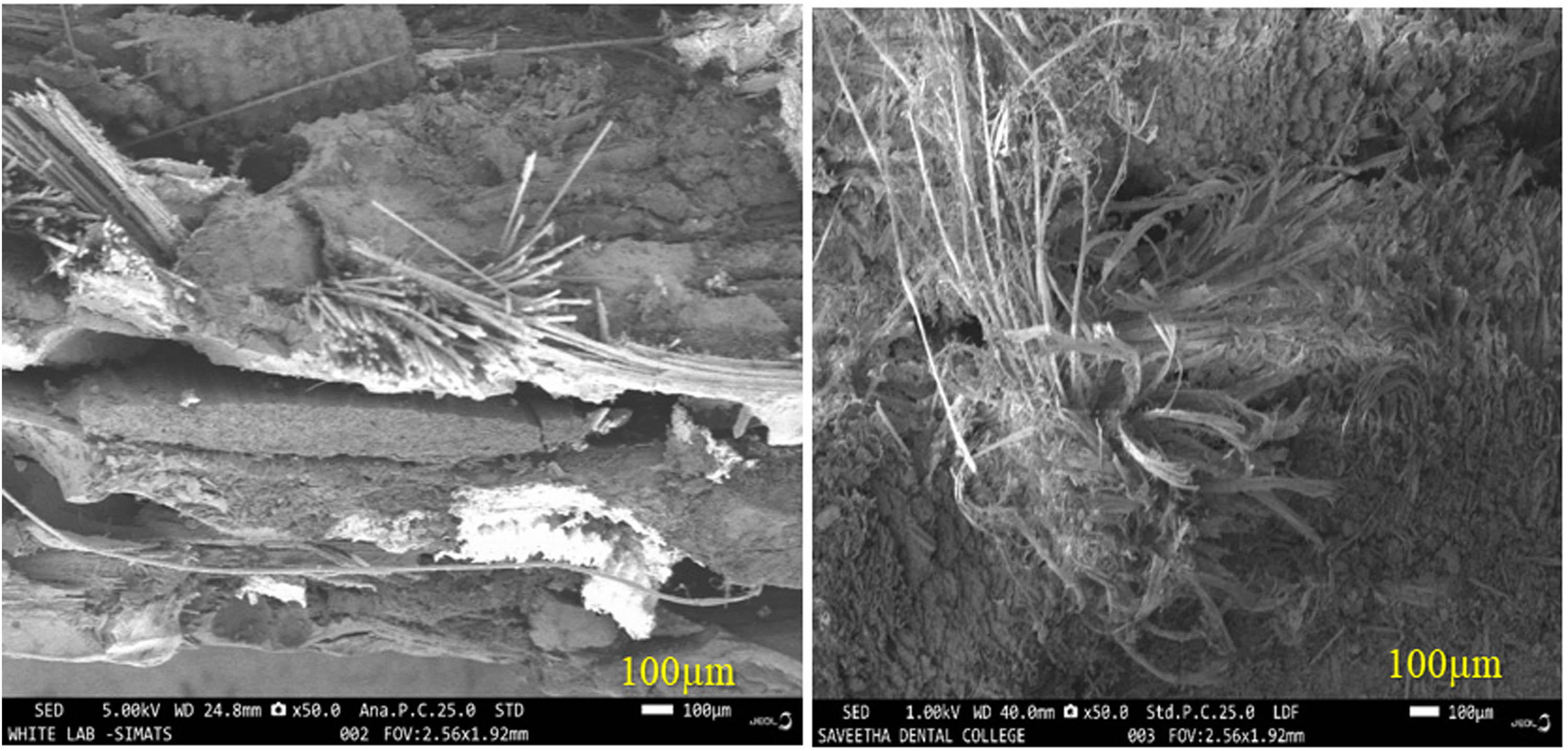 Figure 4 
                  SEM image of hybrid composite.
               