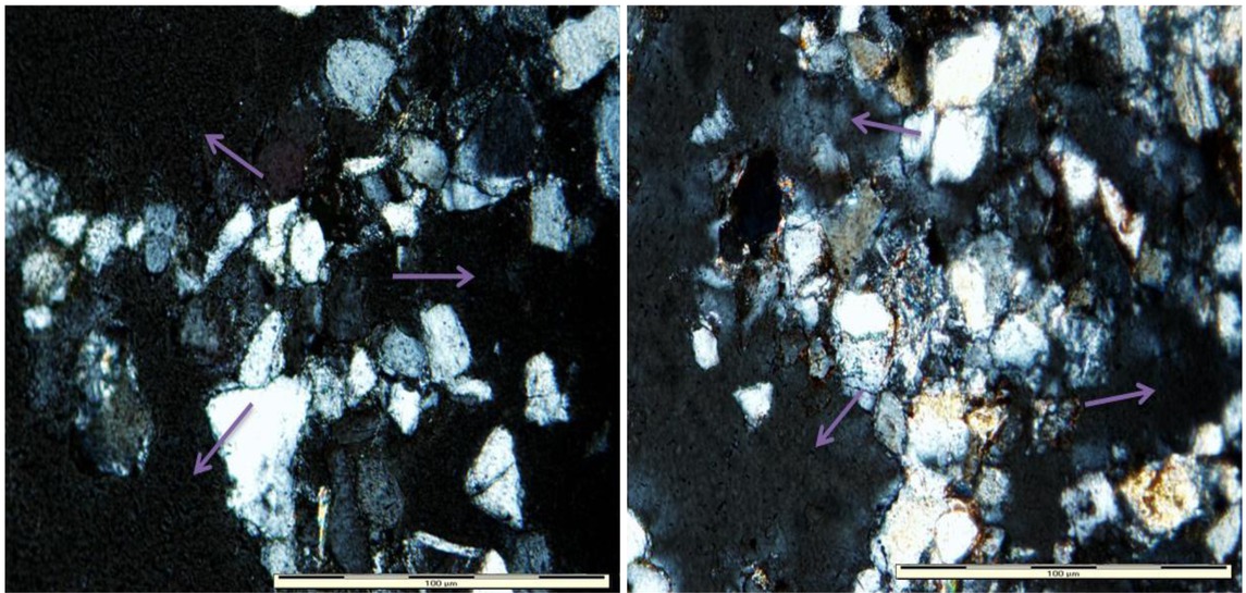 Figure 23 Photomicrographs showing a vast network of pores (dark areas indicated by arrows) (Sample Cd6d).