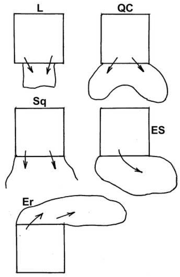 Figure 6 Five types of failure in collapsible soil systems; a very simple cartoon overview. L loess, QC quick-clay, S sand, Est estuarine silts, Er wind erosion of a silty soil. L fails by compaction, the others are disintegrative, dispersive failures.
