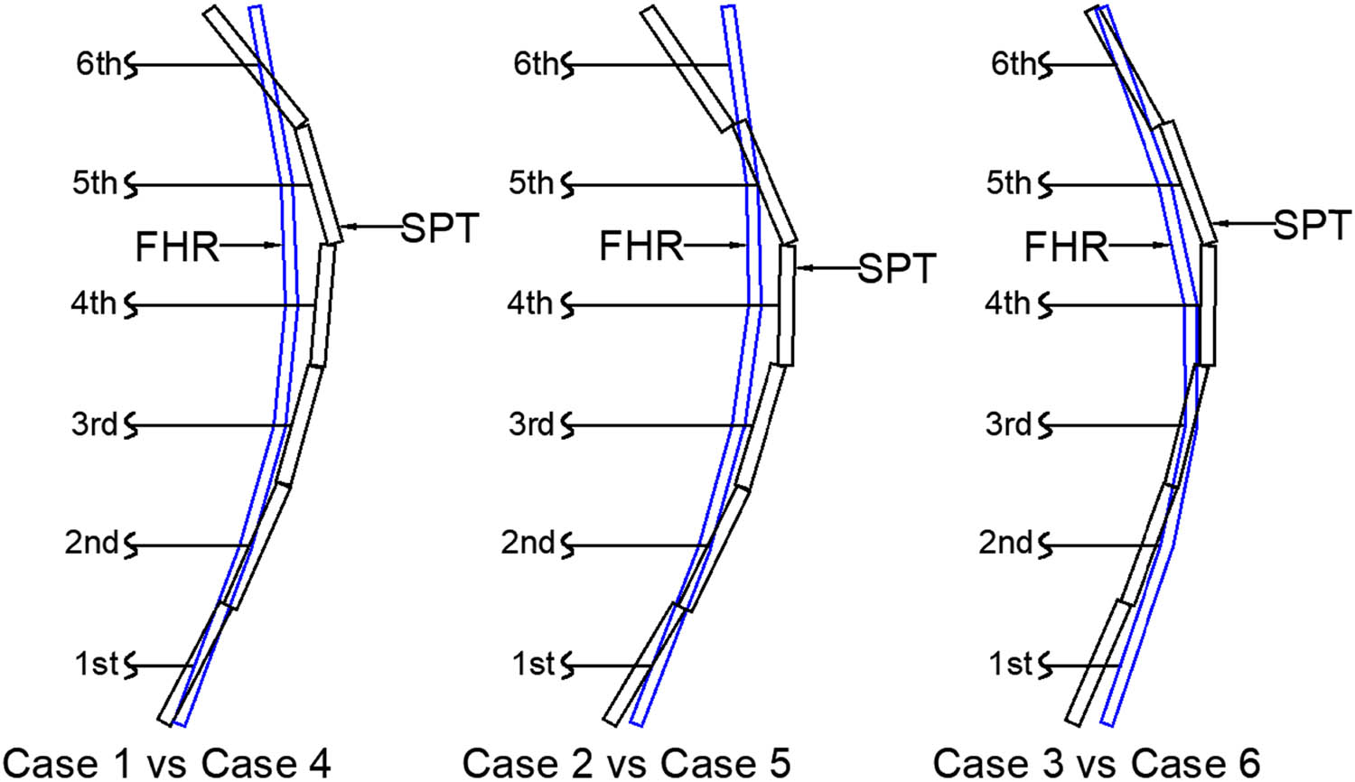 Figure 10
Sketch of the wall facing profile between full height rigid (FHR) facing and segmental panel-type (SPT) wall facing at 40 kN load.
