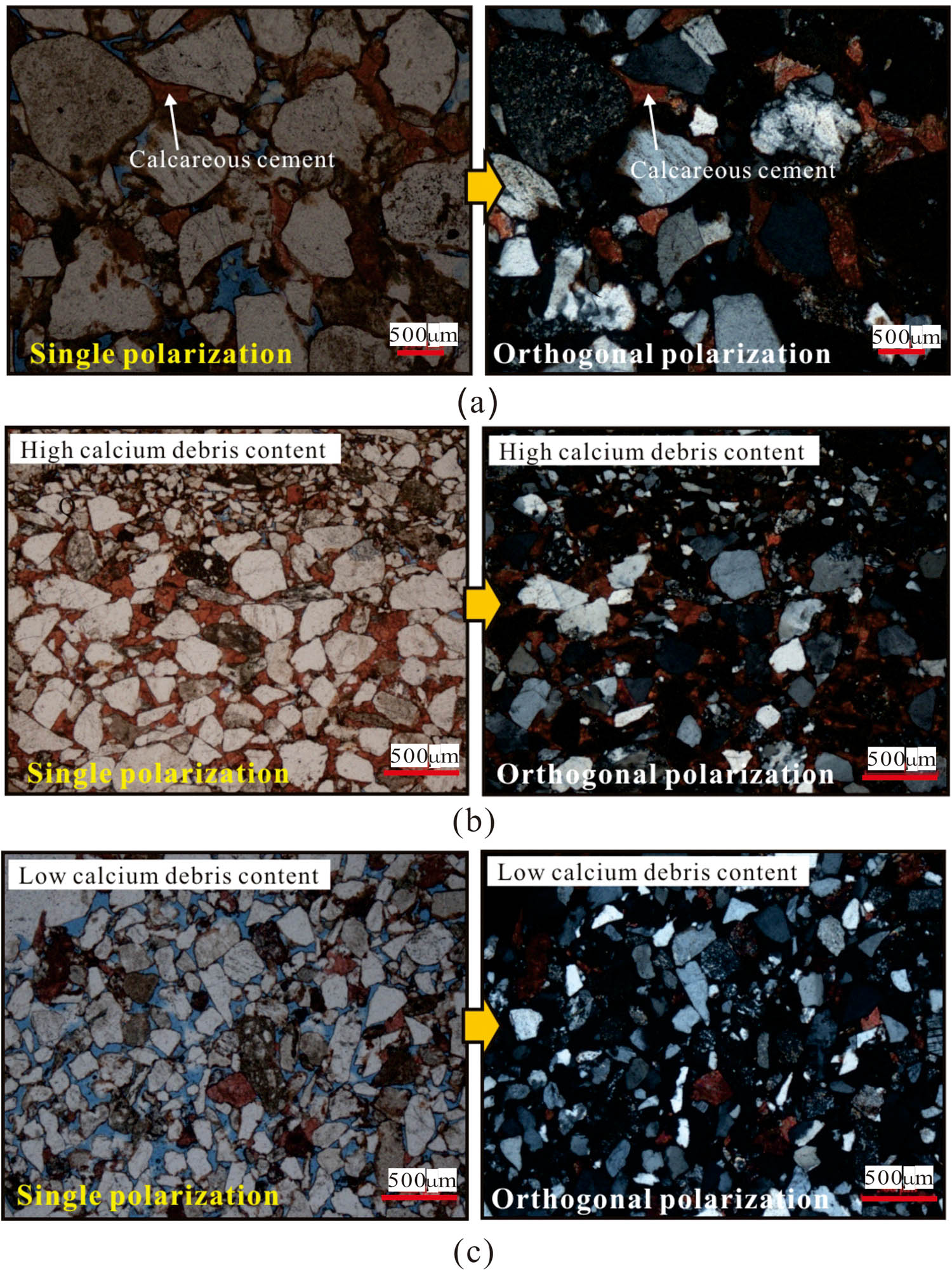 Figure 5 
                  Microscopic features of calcareous cement in the K1bs sandstone segment of Block S3-1: (a) Well S3-5, 5075.69 m, (b) Well S3-1, 5018.30 m, and (c) Well S3-9, 5069.77 m.
               