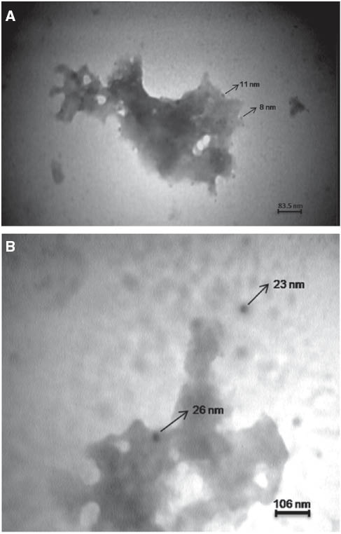 Figure 2 Transmission electron microscopy (TEM) micrographs recorded from a drop-coated film of an aqueous solution of Ag+ ions incubated with dried S. boulardii (after 5 h biotransformation). Magnifications are: (A) 25,000 and (B) 20,000.