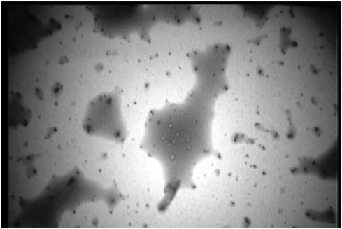 Figure 3 Transmission electron microscopy (TEM) micrograph recorded from a drop-coated film of an aqueous solution of Ag+ ions incubated with freshly cultured S. boulardii (after 5 h biotransformation). Magnification is: 5000.