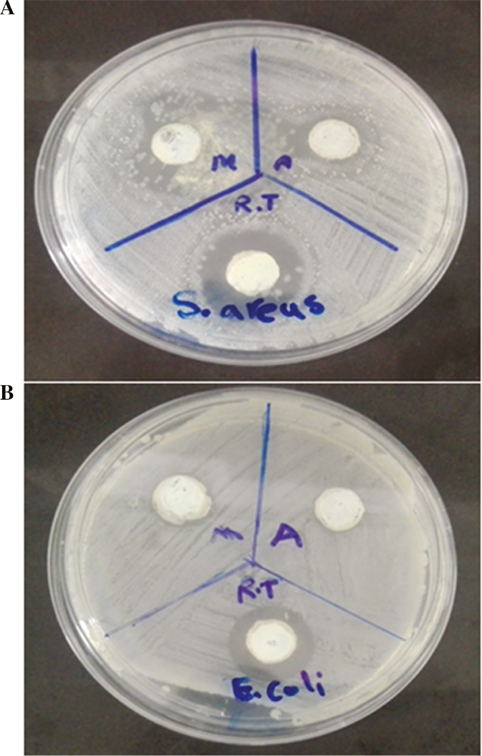Figure 4: Antibacterial activities of the fabricated ZnO NPs using Pelargonium leaf extract and three heating methods to Staphylococcus aureus (A) and Escherichia coli (B).