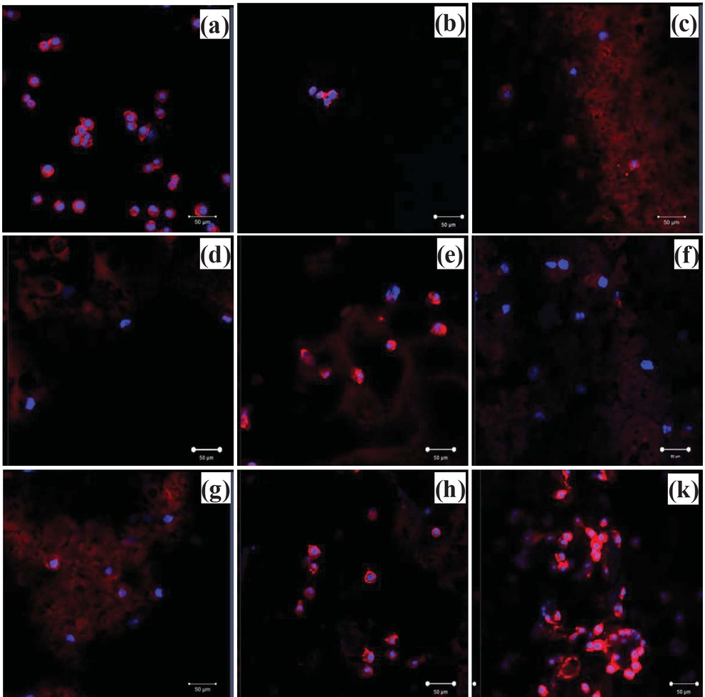 Figure 12 Confocal laser scanning microscopy images of L-929 fibroblasts on scaffolds, cultured for 24 h: (a) TCPS, (b) PLA dense scaffold without pore and (c) porous scaffold without HA. (d), (e) and (f) are the images from PLA scaffol ds that contained HA ranging from 5%, 10% to 15% respectively and (g), (h) and (k) are the images from PLA scaffolds that contained HA grafted collagen ranging from 5%, 10% to 15%, respectively (scale bar = 50 μm).