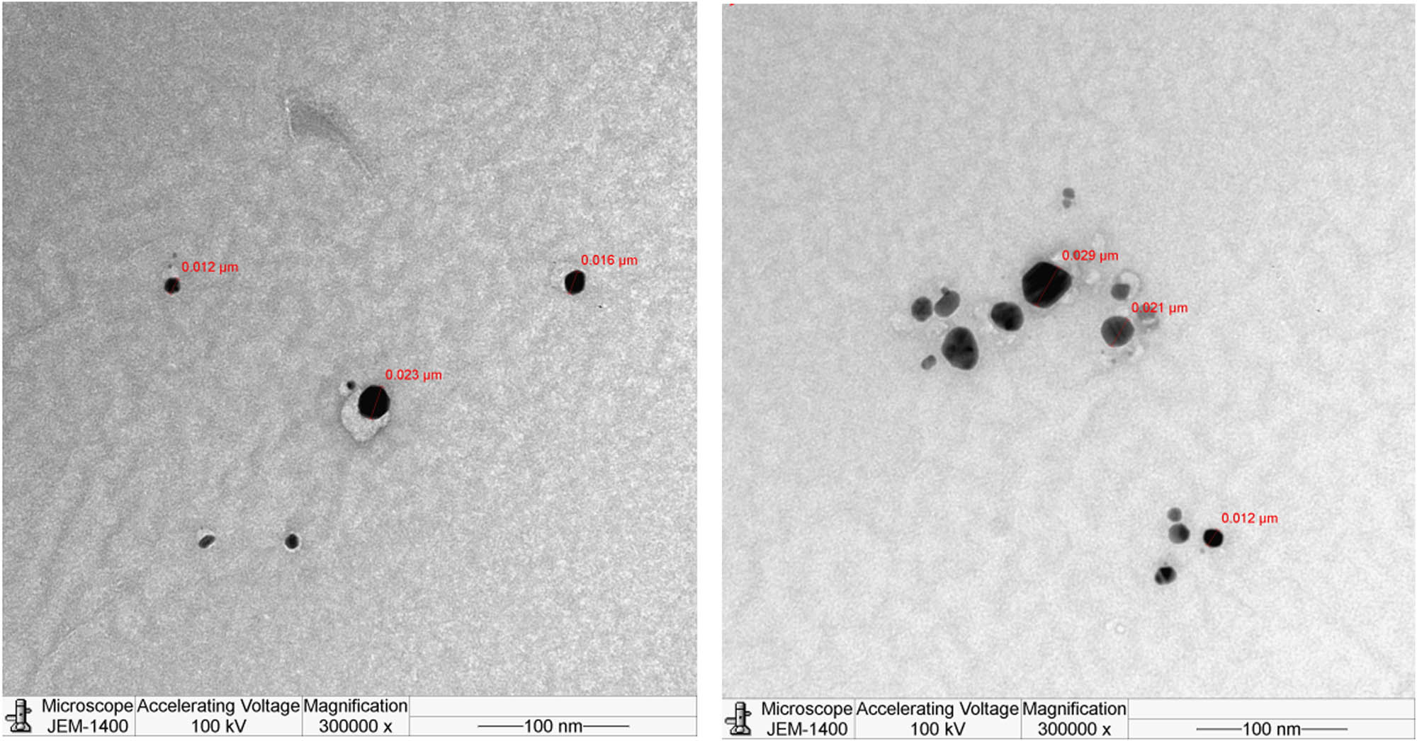 Figure 6 TEM micrograph of the biosynthesized AgNPs prepared with aqueous R.
                     officinalis leaf extract (particle size shown in range from 12 to
                  22 nm).