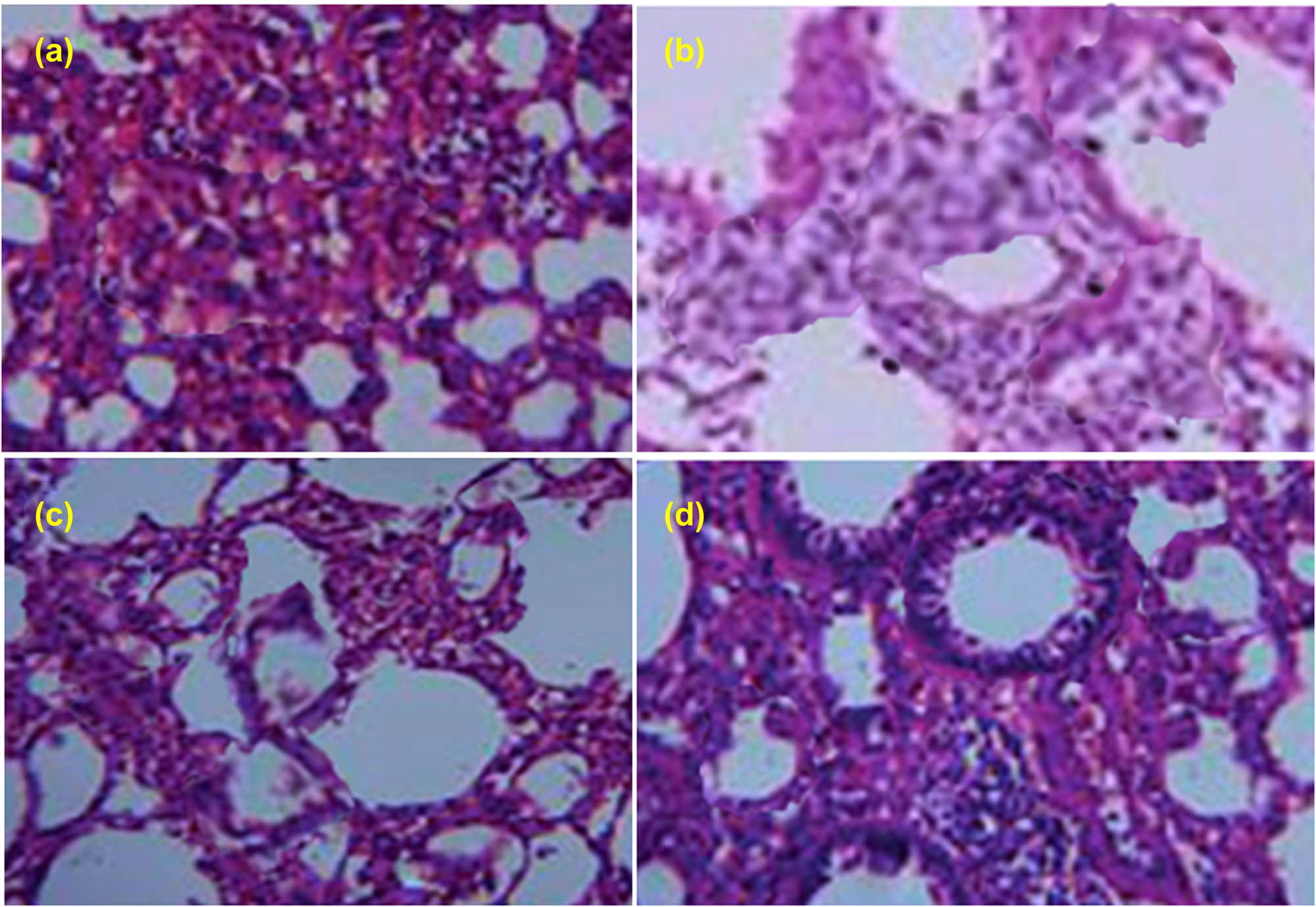 Figure 8 Histological images of lungs in mice showing the effect of AuNPs: (a) group I (control); (b) group II (pneumonia induced); (c) group III (AuNPs treatment at 20 mg/kg); (d) group IV (AZM treatment at 0.10 g/kg).